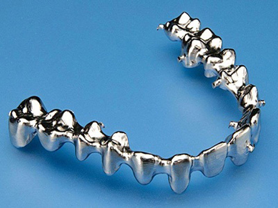 DMLS at GTR Dental Lab