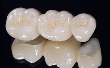 Zirconium at GTR Dental Lab